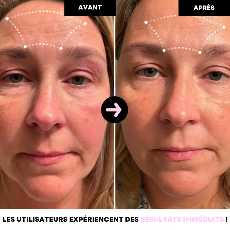 Masque de Nuit au Collagène (+ Applicateur Offert) - GlowRevive™